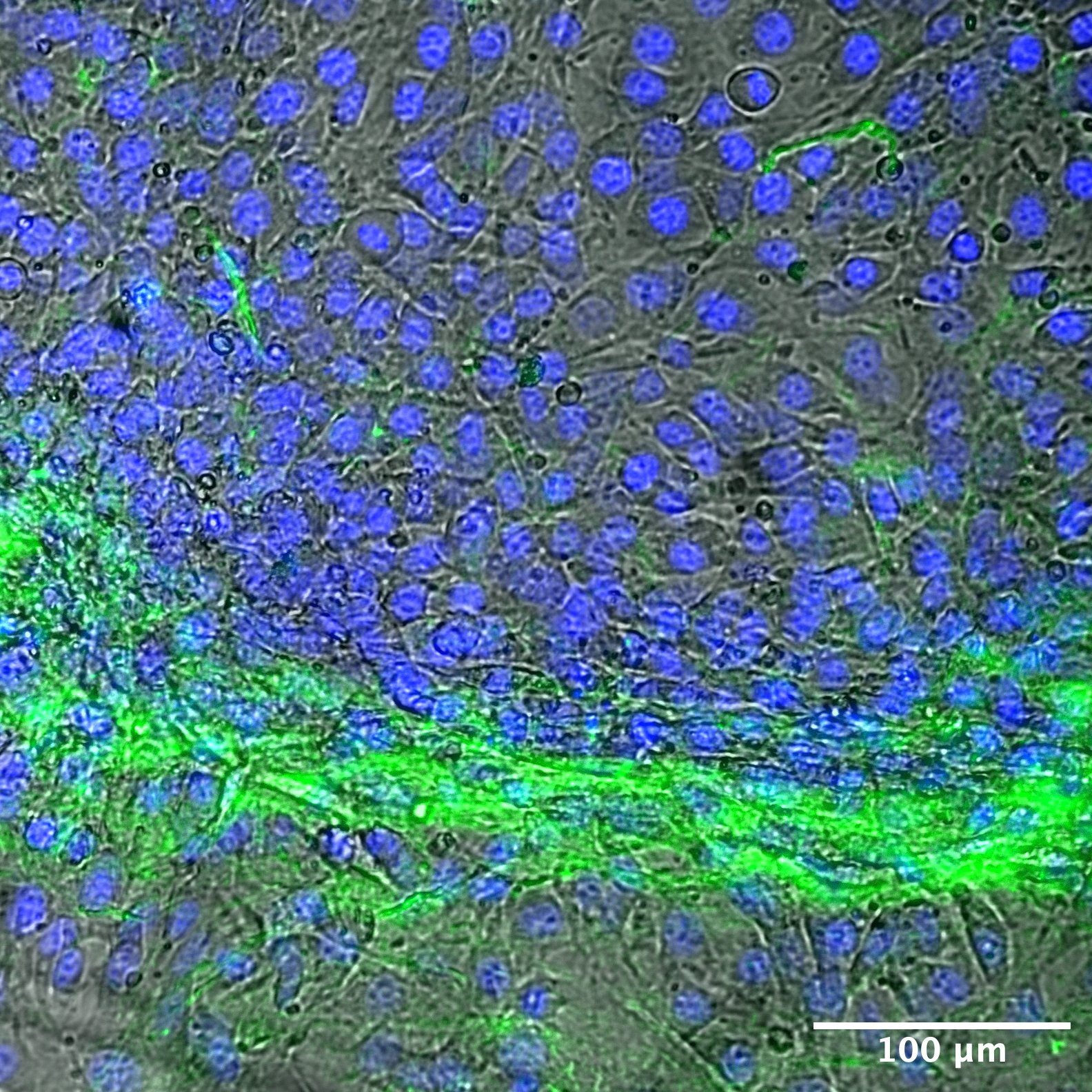 Live cell imaging of fibroblasts invading a collagen:microgel composite.