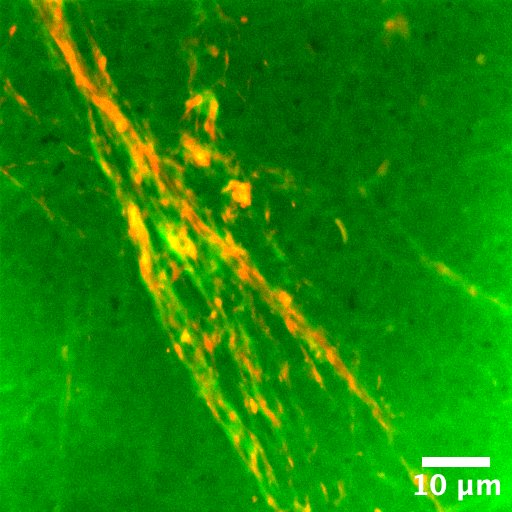 Confocal imaging of water partitioning to the surface of collagen fibers within a collagen:microgel composite.