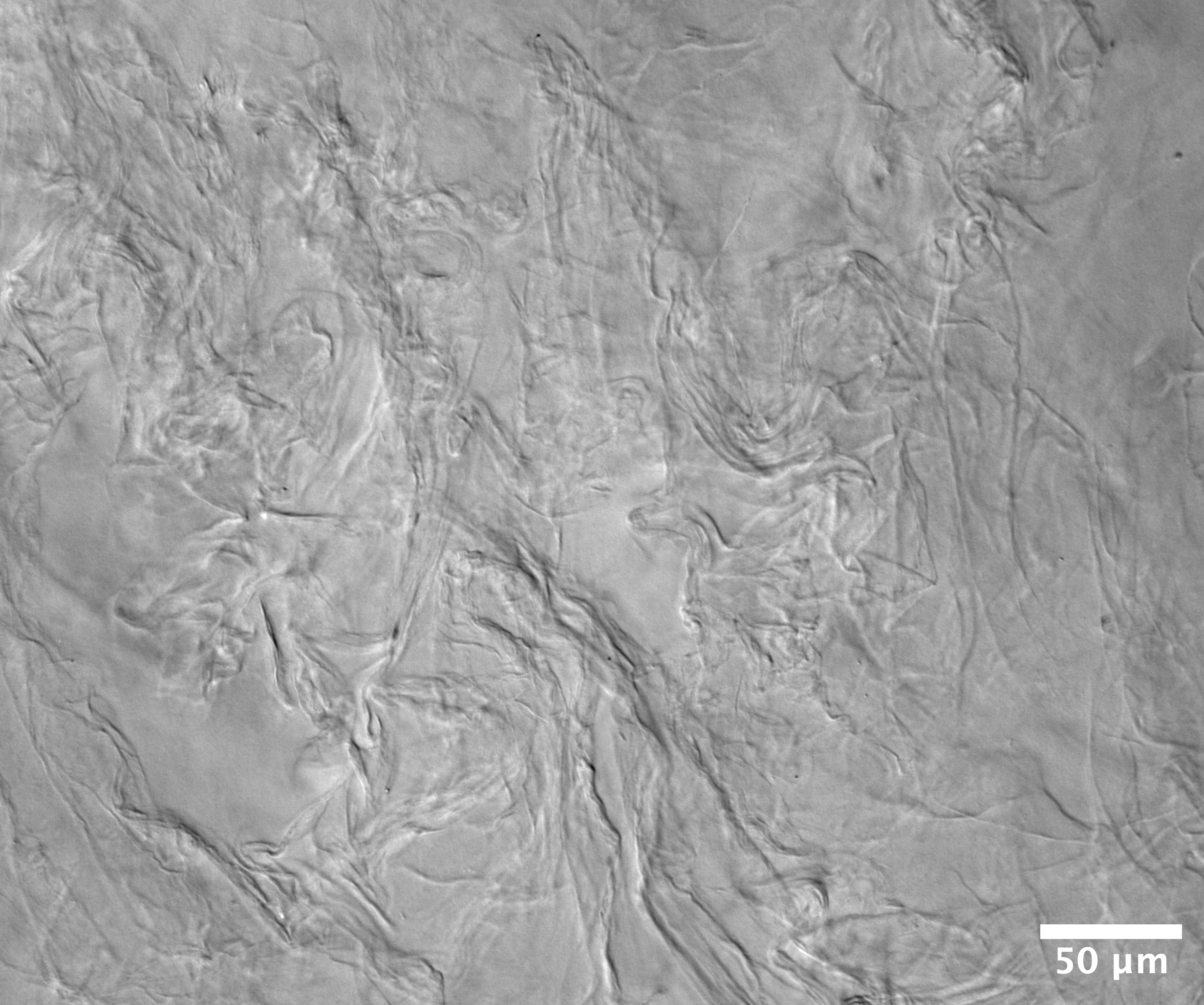 Crowding-induced collagen bundling in a microgel paste