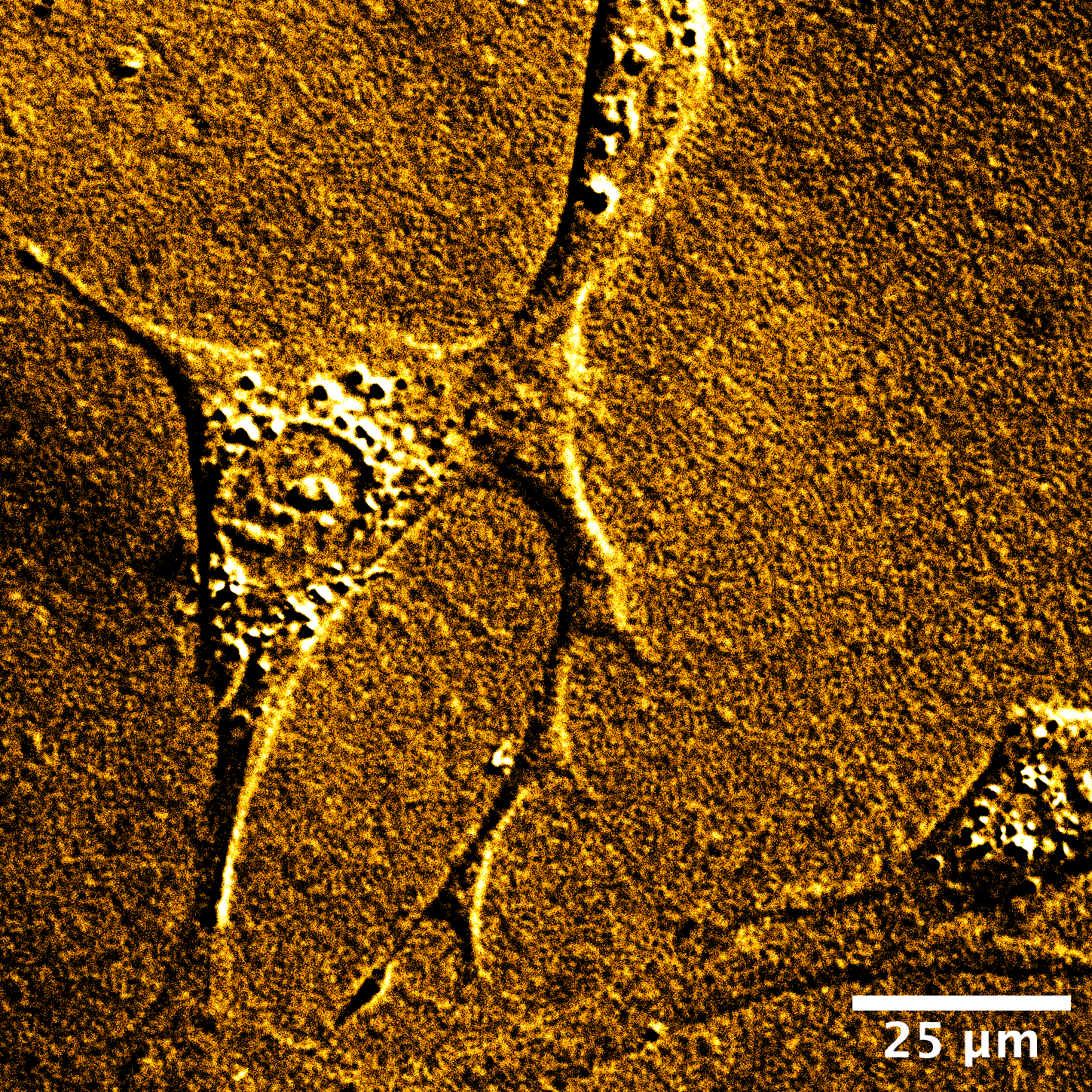 Fibroblasts spreading inside of a microgel paste biomaterial
