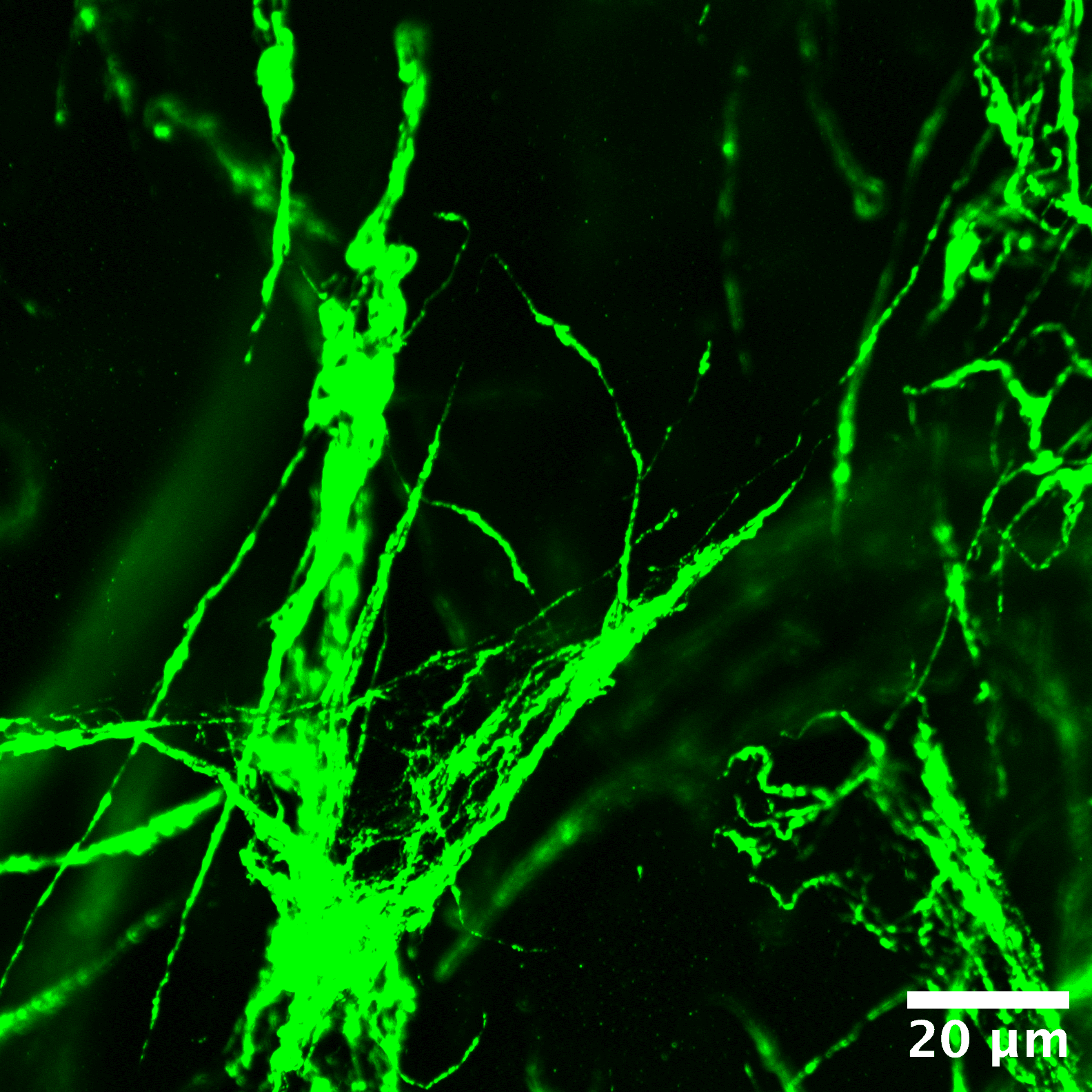 Animated confocal z-stack of collagen:microgel composite