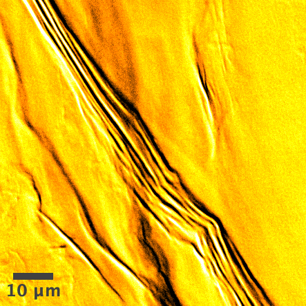 Microscopy of collagen fibers