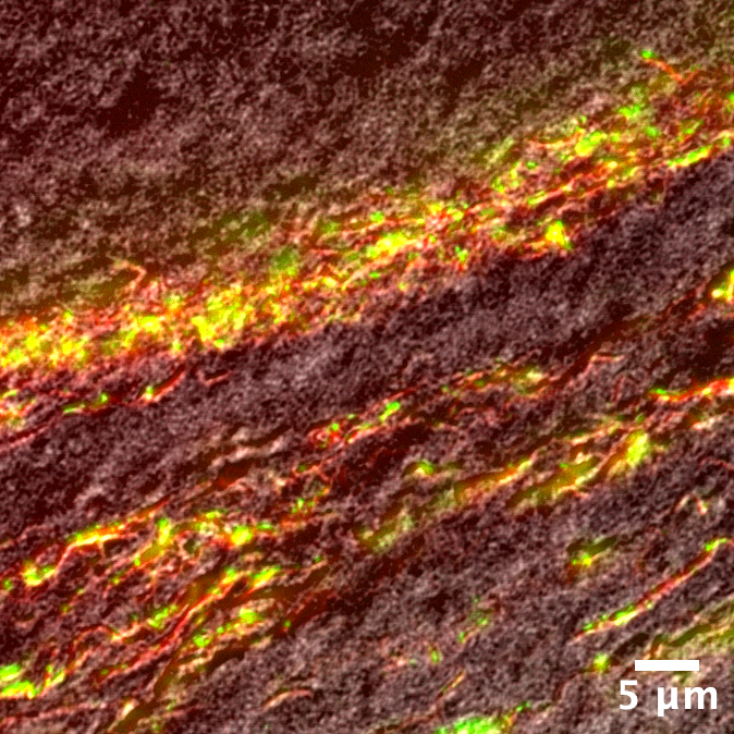 Two color imaging of dyed collagen in a microgel paste with dyed dextran partitioned into water-rich regions.